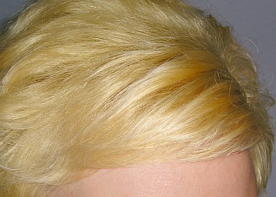Blonde Haare